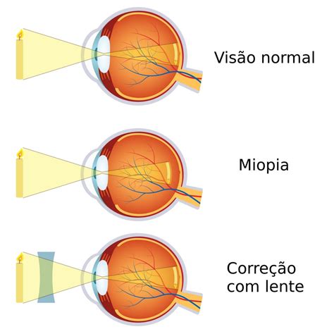 visão curta