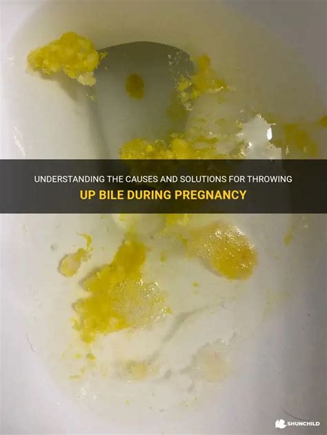 vomiting bile when pregnant