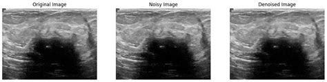 wavelet denoising application medical imaging Reader