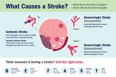 what causes a stroke to happen