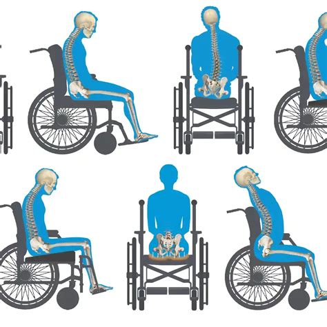 wheelchair users postural seating a clinical approach Doc