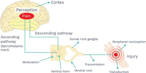 which examination visualizes nociceptive paim