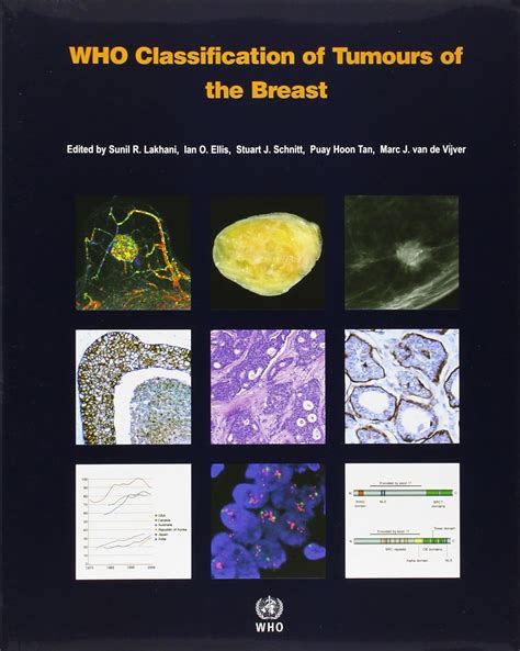 who classification of tumours of the breast iarc who classification of tumours Reader