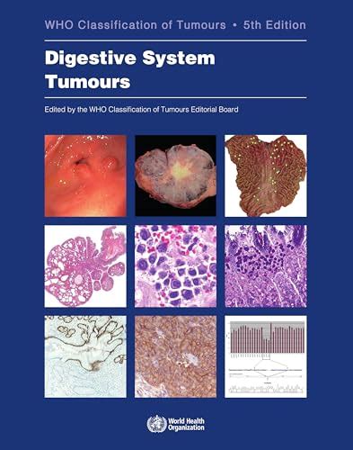 who classification of tumours of the digestive system iarc who classification of tumours Kindle Editon