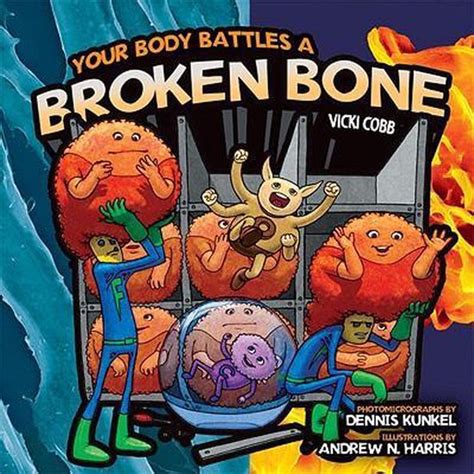 your body battles a broken bone Doc