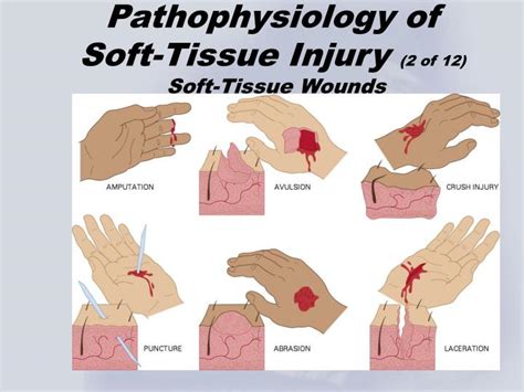 yung hui practice the diagnosis and treatment of soft tissue injury Epub